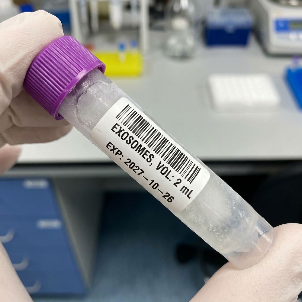 frozen exosome.