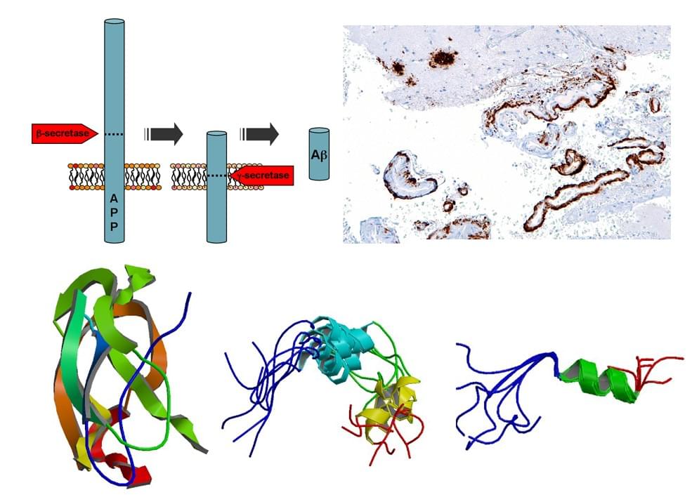 Custom MemPro™ Services for Amyloid beta (A4) Protein
