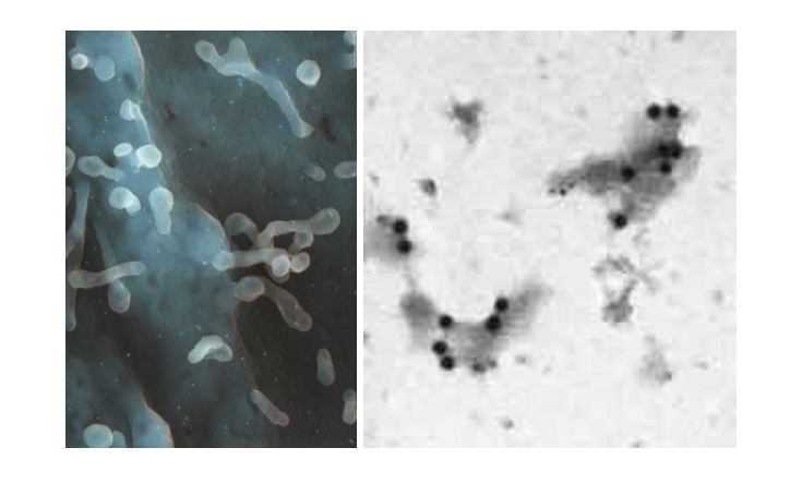 Immuno labeled spiny dendrite cell-SEM (left) and Double labeled cell membrane fragments (right).