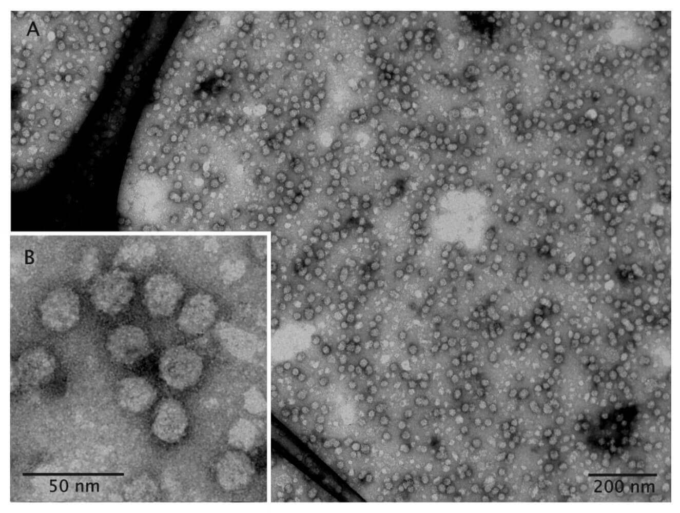 Mempro™ Virus-like Particles (VLPs) Production in Yeast Cells System