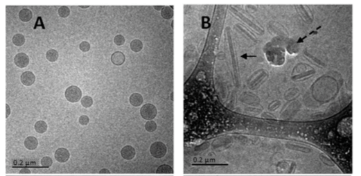 Figure 1. Internal sucrose concentrations have effect on cryoTEM morphology for liposomes before and after freeze–thaw. (D. Cipolla, et al., 2016) 
