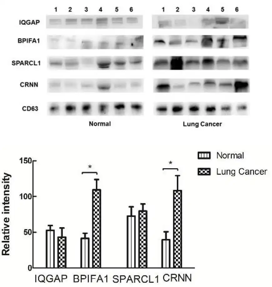 Figure 5. Exosome proteomics analysis.