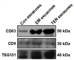 Figure 3. Western blot of exosome marker proteins.