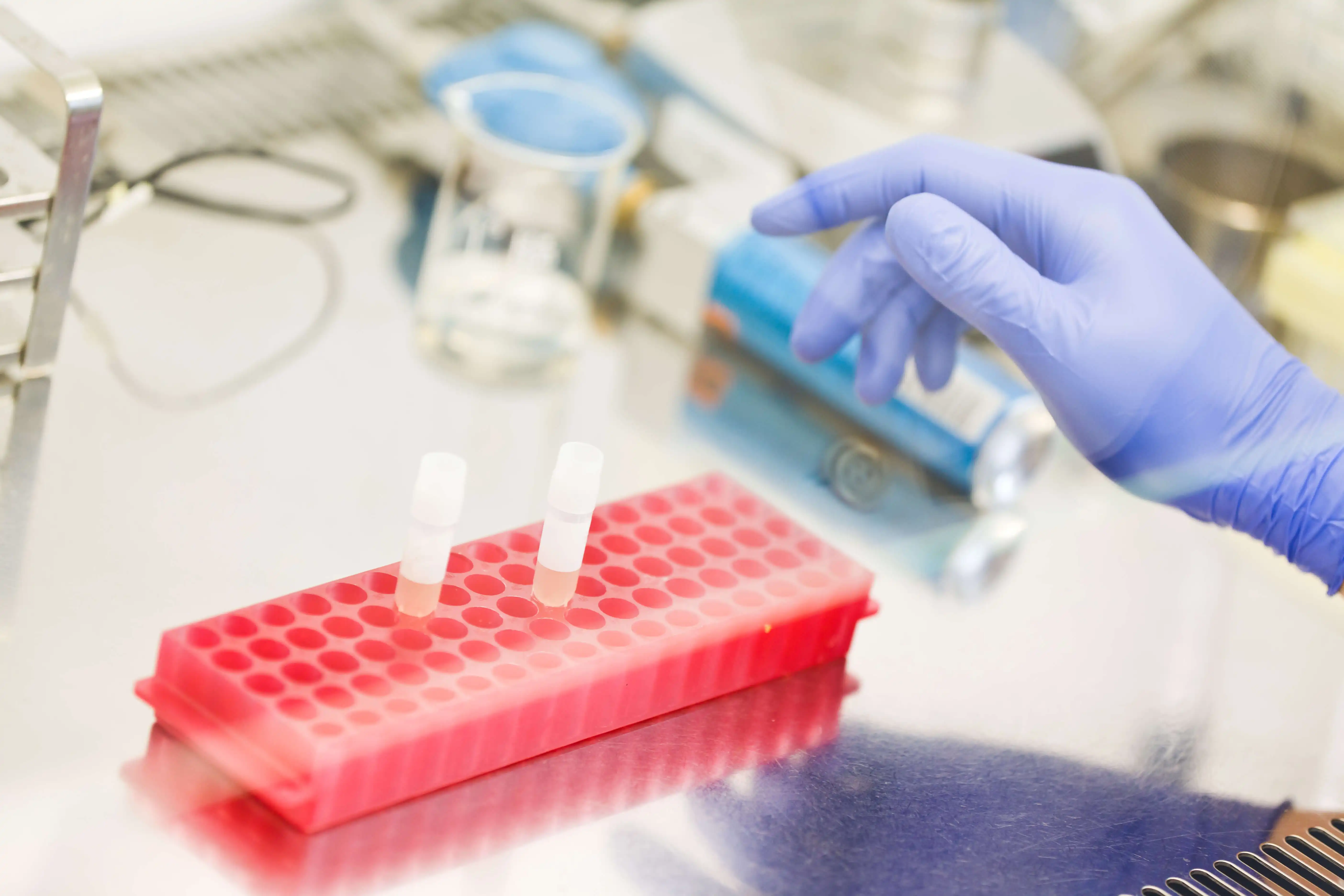 Exosome isolation from body fluids.