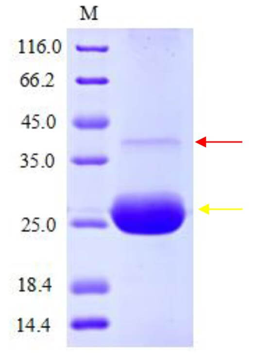 SDS-PAGE analysis showing the purified F2-nanodiscs complex.