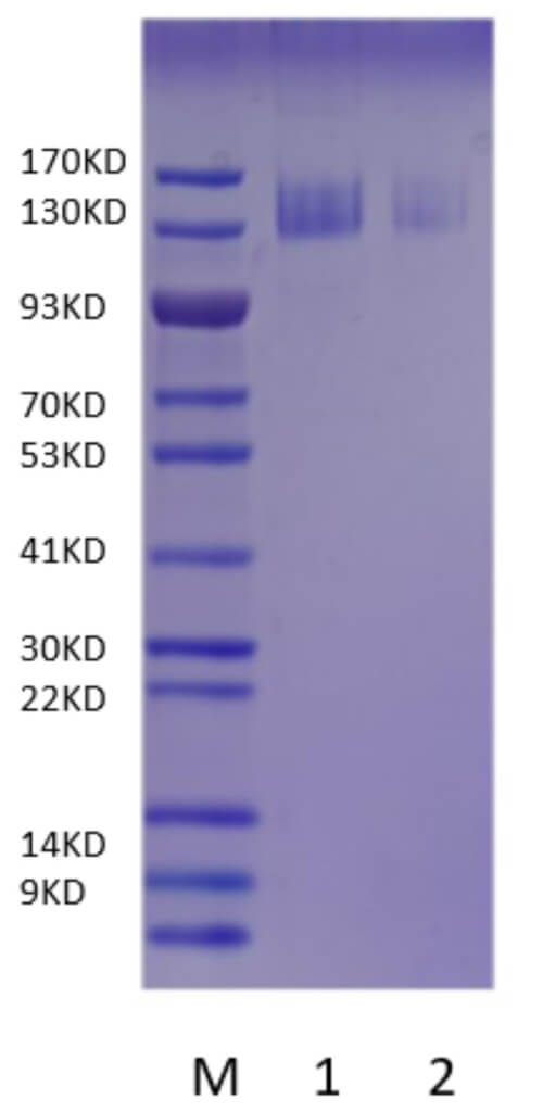 SDS-PAGE analysis of anti-B antibody conjugation on beads.