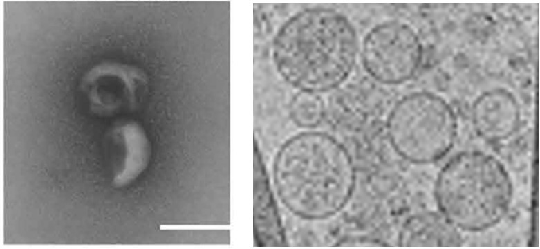 Electron micrographs of exosomes. Left: TEM imaging; Right: Cryo-TEM imaging.