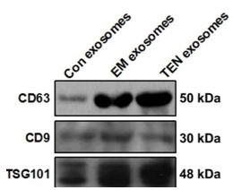 Western blot of marker proteins CD9, CD63, CD81, and TSG101.