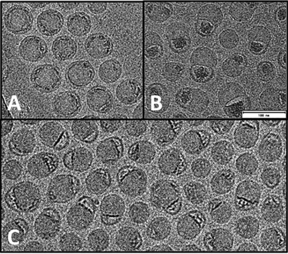 Cryo-EM images showing spherical and nonspherical mRNA-LNP morphologies with varying mRNA-lipid association states.