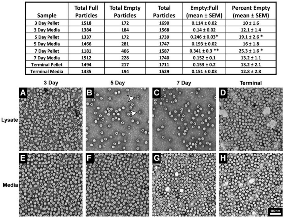 Transmission electron microscope images showing the ratio of empty to full AAV particles, with empty particles marked by an electron-dense core.