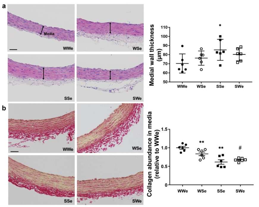 Effects of plasma exosomes on thoracic aorta wall thickness and collagen abundance in Wistar Kyoto rats (WKY) and spontaneously hypertensive rats (SHR), including representative histological images and quantitative analyses.