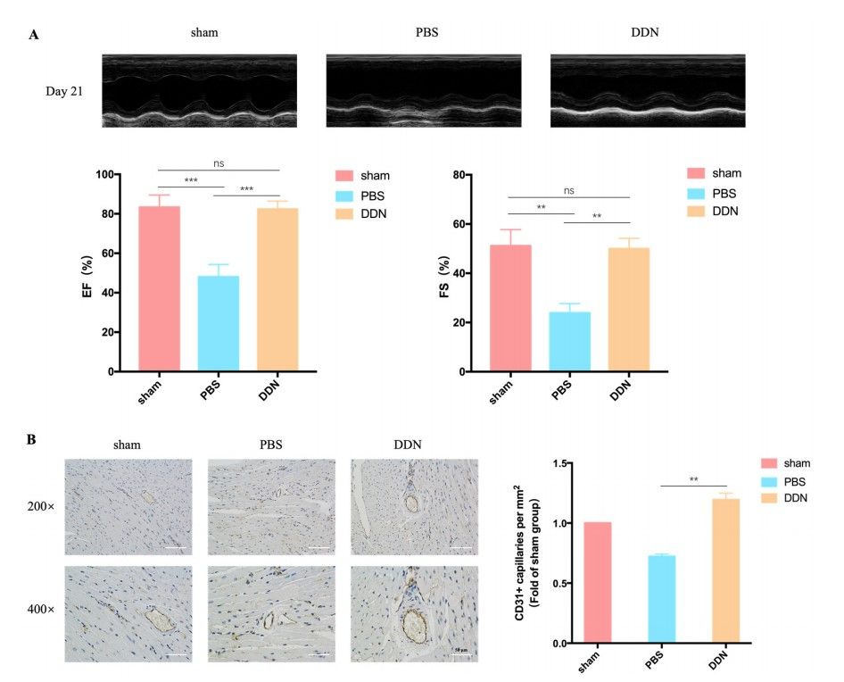 Graph showing improved cardiac function through Salvia miltiorrhiza-derived exosome-like nanoparticles, with enhanced ejection fraction and fractional shortening.