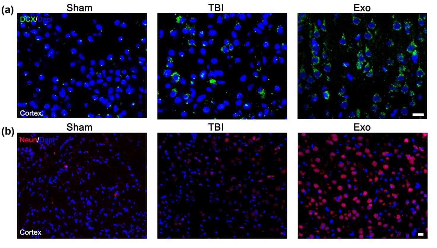 Figure 2. IV-infused exosomes promote neuronal regeneration.