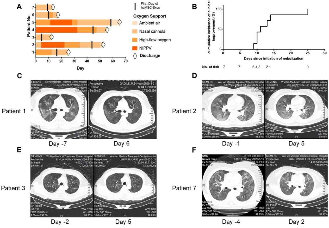 Figure 2. Nebulized inhaled exosomes for the treatment of COVID-19.