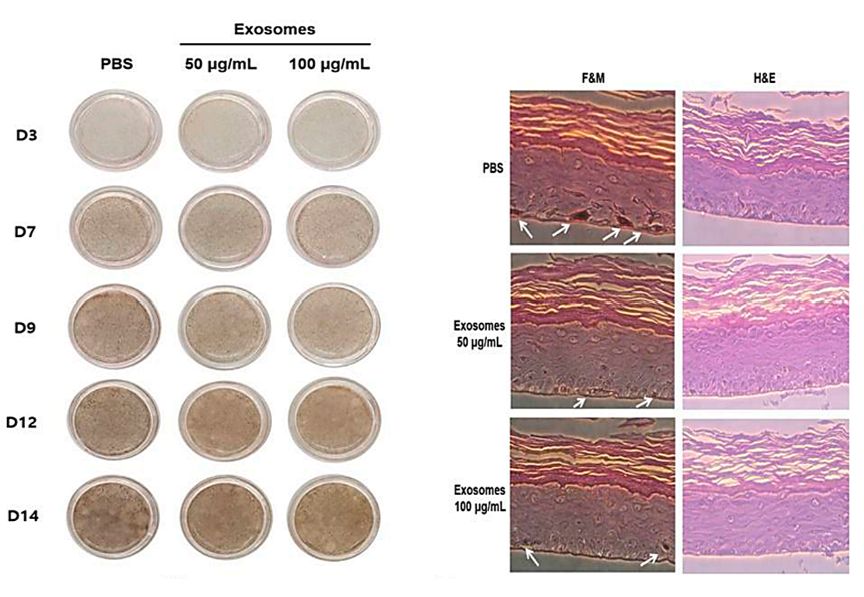 Figure 4. Milk exosomes can be used for whitening.