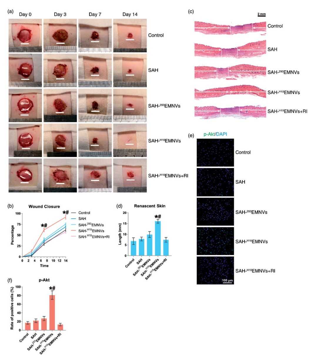 Figure 3. EMNV delivers LncRNA-H19 to promote diabetic wound healing.
