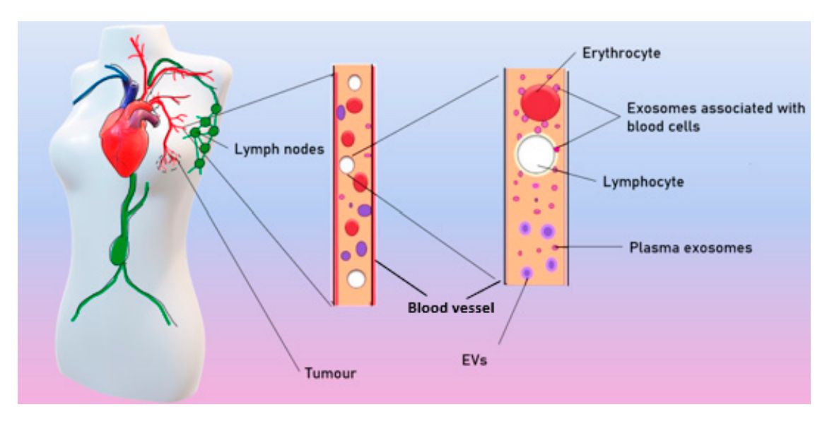 Figure 1. Development of tumor exosomes.