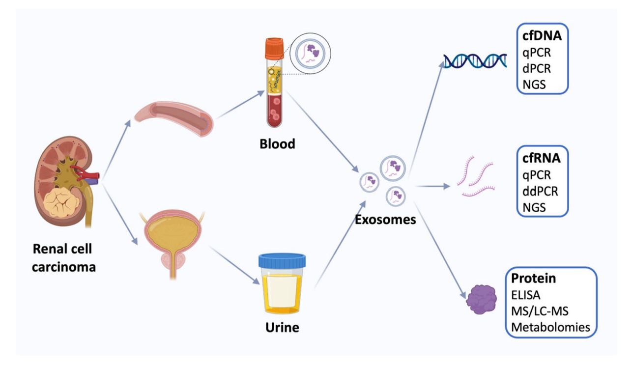 Figure 2. Exosomes for renal cell carcinoma diagnosis.