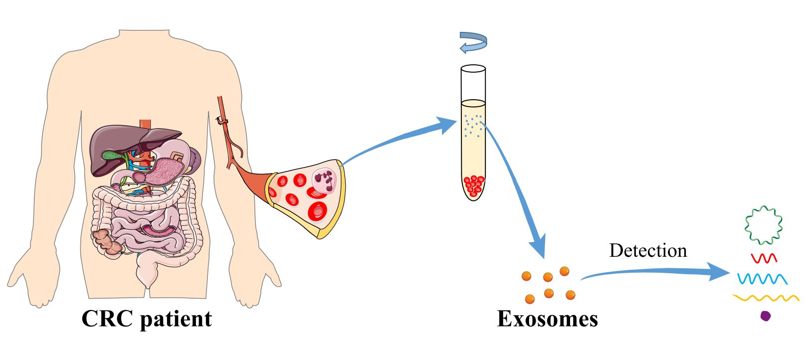 Figure 2. Exosomes as diagnostic biomarkers in CRC.