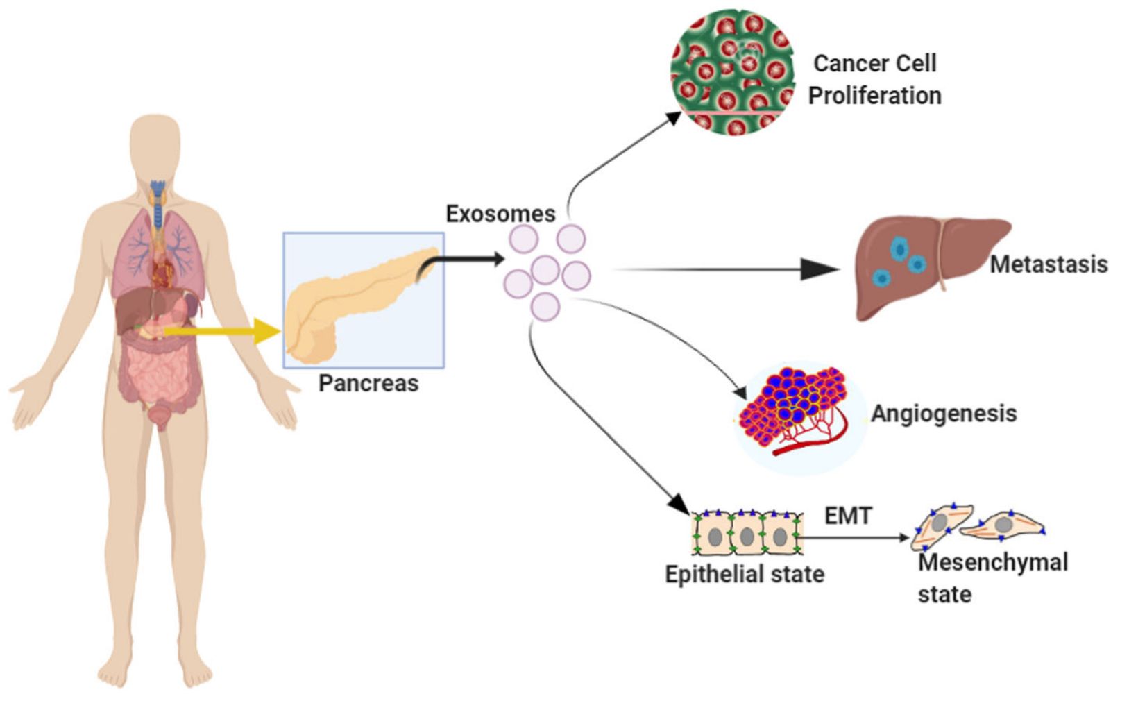 Figure 1. The role of exosomes in pancreatic cancer progression.