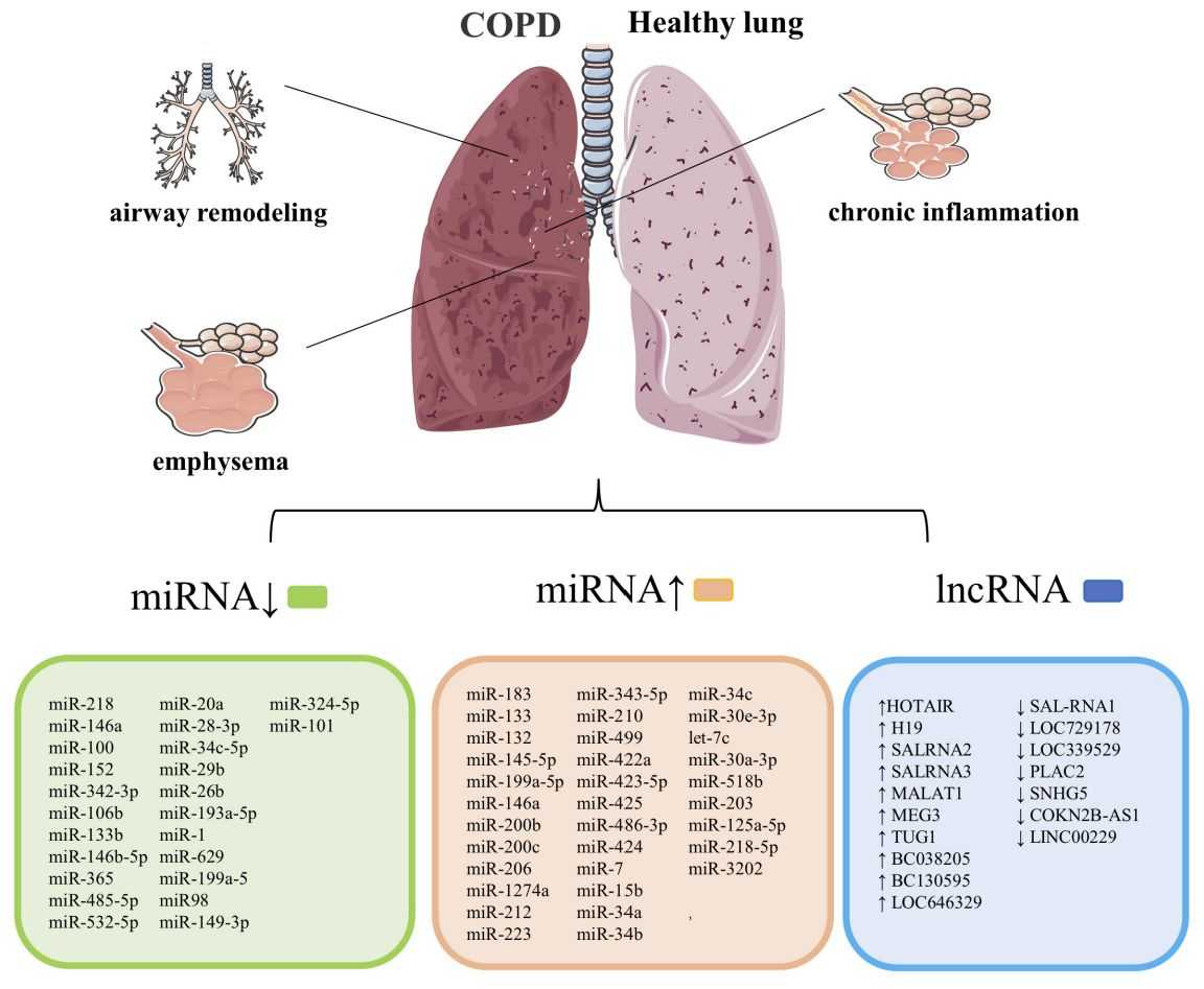 Figure 1. Exosomes are strongly associated with the course of COPD.