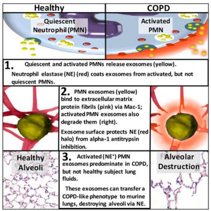 Figure 2. Activated PMN exosomes lead to COPD.