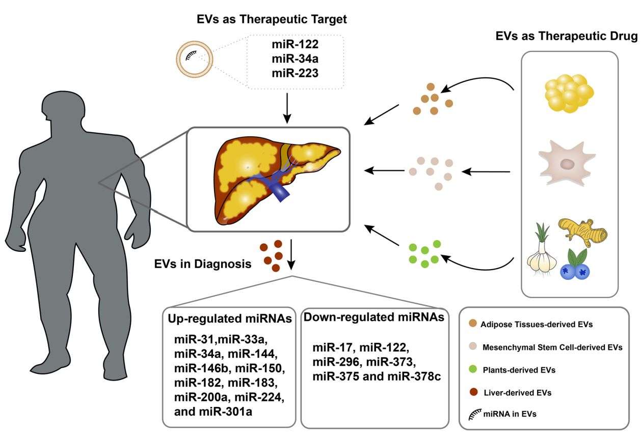 Figure 3. Exosomes for the treatment of obesity-induced non-alcoholic fatty liver disease.