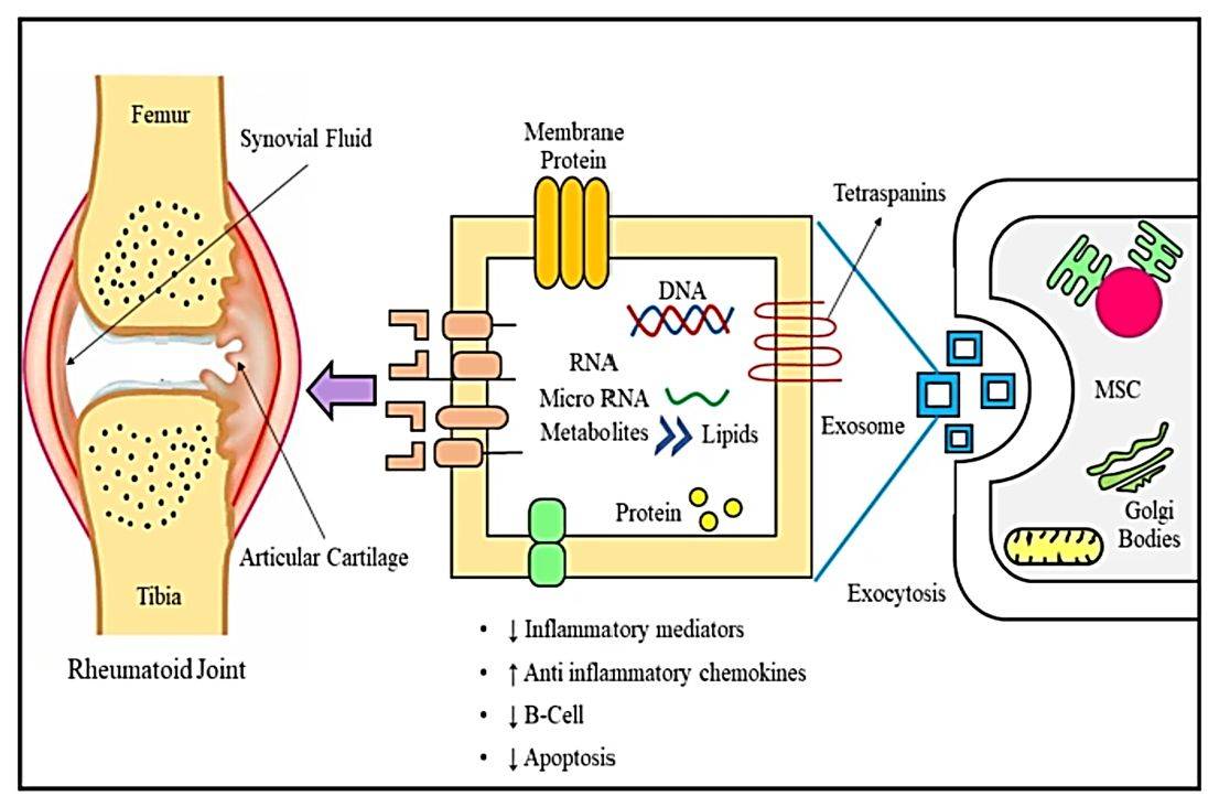 Figure 2. The role of exosomes in RA.