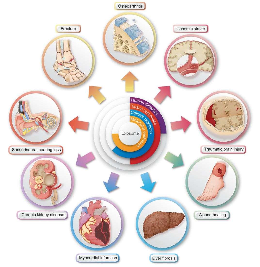 Figure 3. Applications of exosome therapy.