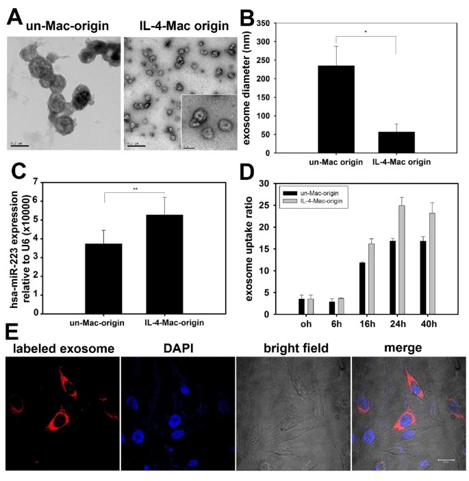 Microscopy images and qRT-PCR results show that exosomes secreted by macrophages shuttle miR-223 to breast cancer cells.