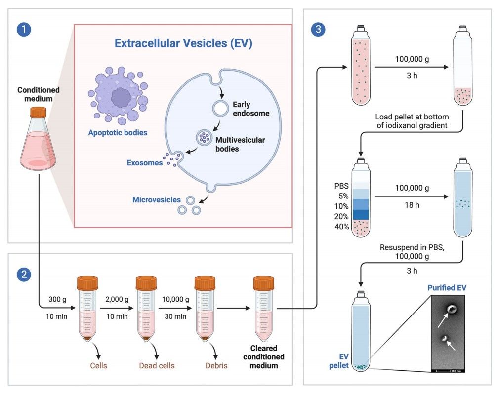 The process of isolation of extracellular vesicles from medium.