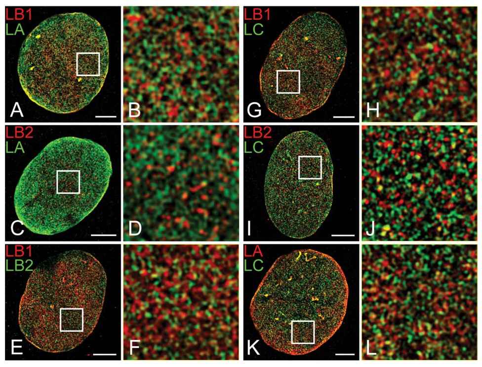 Example of structural organization of nuclear lamins revealed by super-resolution microscopy.