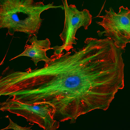 Microfilaments and microtubules illustrated in fluorescent microscope image.