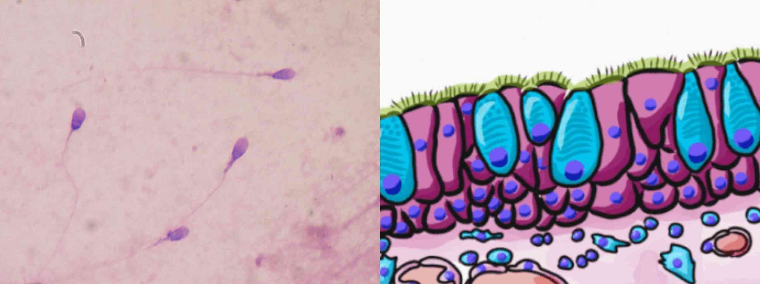 Example of flagella and cilia: sperm cells and epithelium cilia.