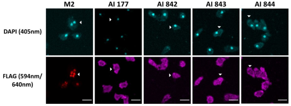 Immunofluorescence microscopy of cells expressing a Flag-tagged protein.