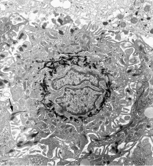 An example of studying cellular ultrastructure with TEM.