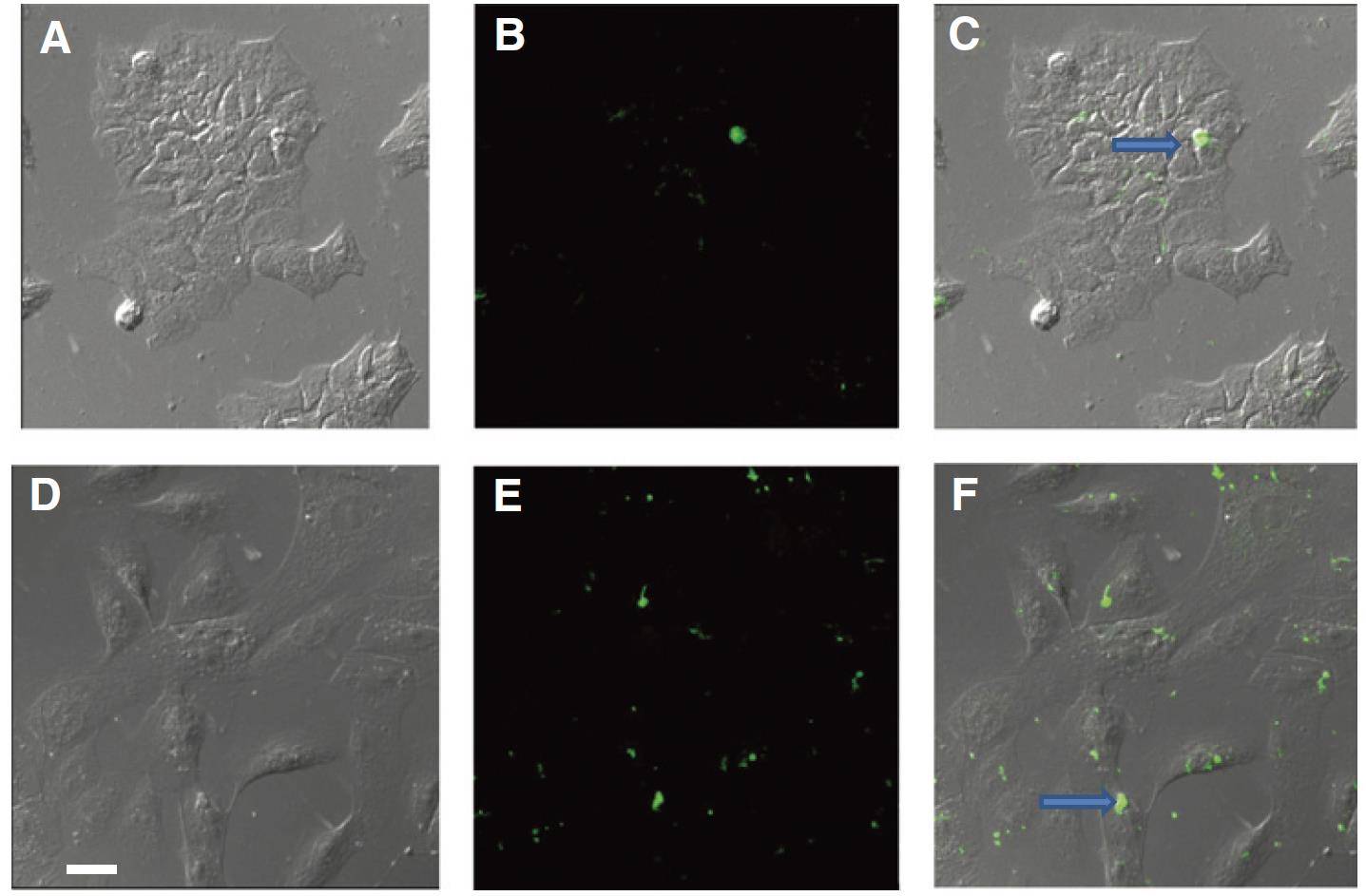 Figure 3. Confocal microscopy images of MCF7 and MCF10A cells treated with GFP-labeled exosomes showing binding to CD63 and internalization of exosomes within breast cells.