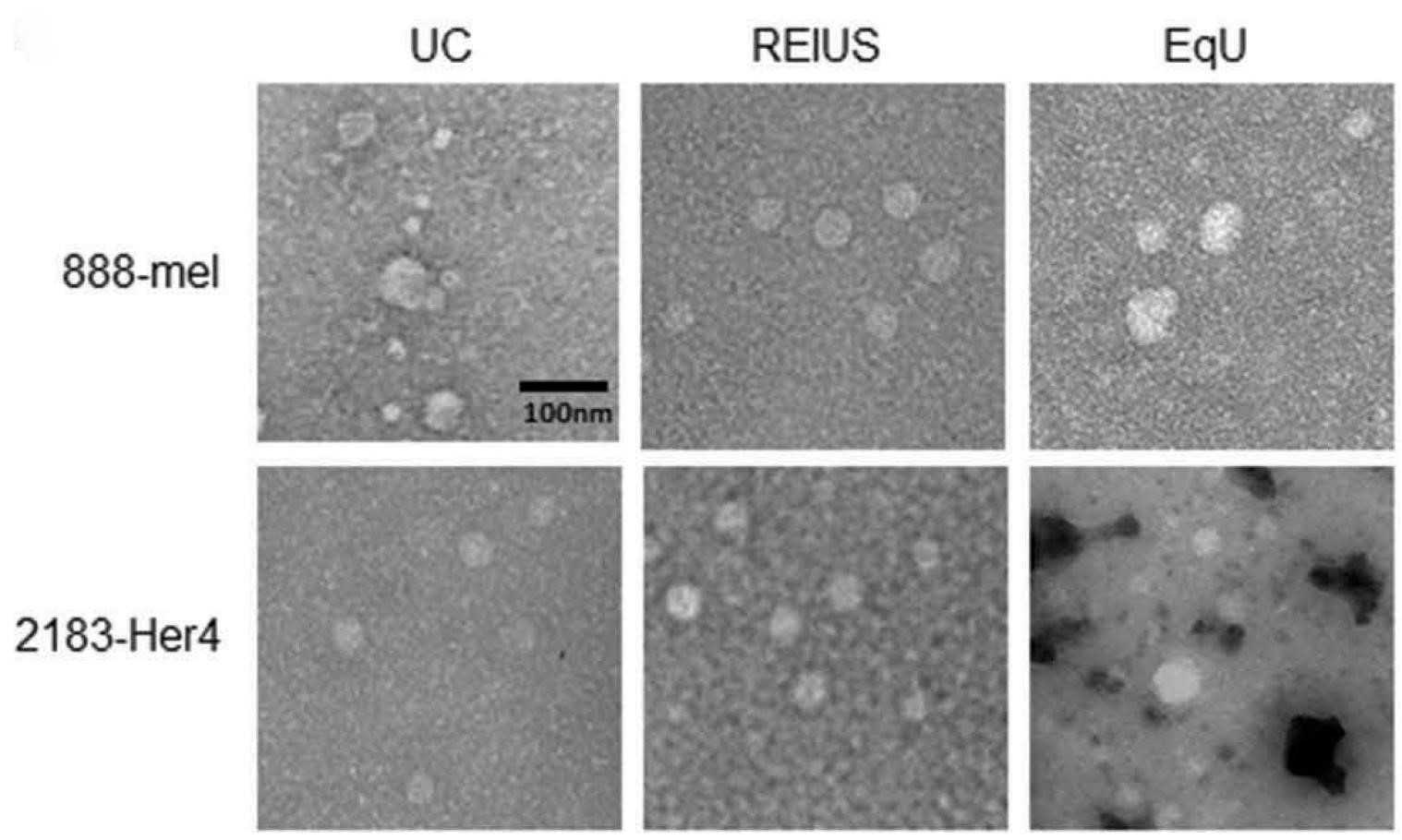 TEM images of melanoma exosomes showing circular morphology and intact membranes after isolation.