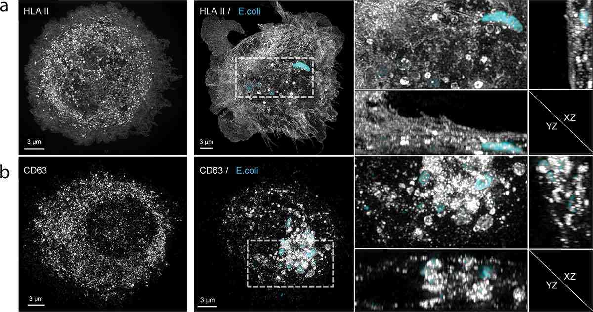 Figure 2. Redistribution of HLA II and CD63 post-phagocytosis in dendritic cells.